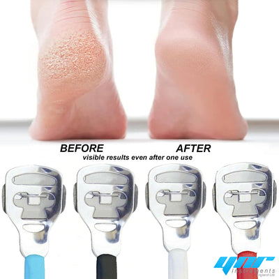 Callus Remover Corn Hard Skin Remover Shaver Foot Scraper Pedicure Kit