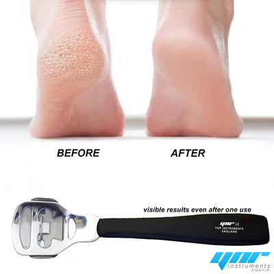 Callus remover Callus Corn Hard Skin Remover Shaver Foot Scraper Pedicure Kit